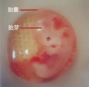 成都公立生殖专科医院专家讲解胎囊、胎芽、空孕囊都是什么
