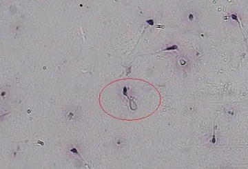 生孩子越来越难到底是什么原因造成的?