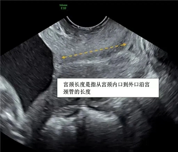 成都看不孕不育哪家医院好-四川省生殖专科医院怎么样