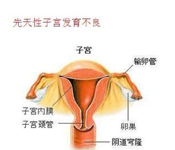 子宫发育不良专业治疗医院