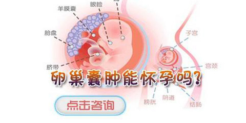 卵巢囊肿治疗方法大全