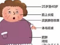 “多囊”治疗多久可以怀孕？