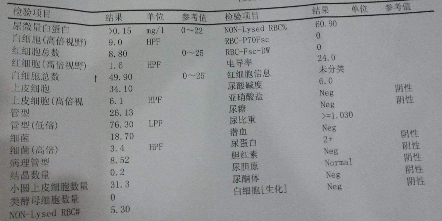 精索静脉曲张的有效治疗方法