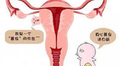 子宫肌瘤术后多久能怀孕？