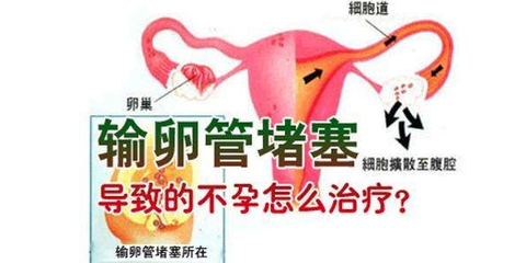 输卵管堵塞，能靠中药吃通吗