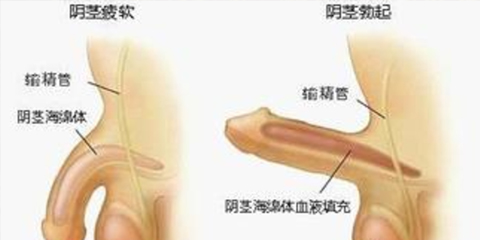 阳痿早泄只能做手术吗